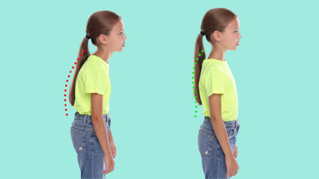 Fix Bad Posture Naturally With These Easy Daily Changes